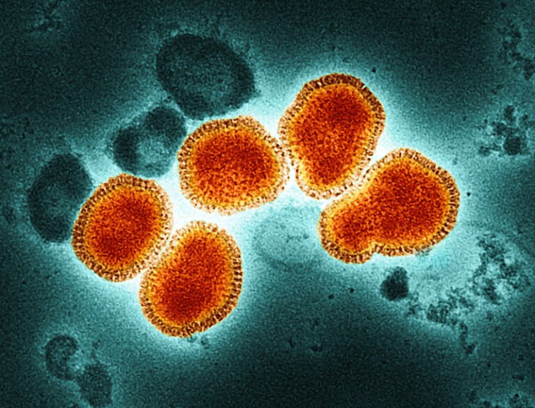 CDC Alerts healthcare providers about measles cases